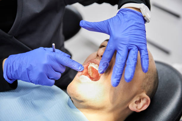 Best Knocked-Out Tooth (Avulsed Tooth) Treatment in Eagle, ID
